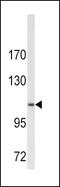 Collagen Type VI Alpha 1 Chain antibody, MBS9214863, MyBioSource, Western Blot image 