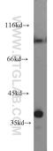 Pyrophosphatase (Inorganic) 2 antibody, 16662-1-AP, Proteintech Group, Western Blot image 