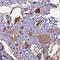 Angiopoietin Like 2 antibody, NBP1-88998, Novus Biologicals, Immunohistochemistry paraffin image 
