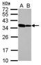 RNA Binding Motif Protein 11 antibody, GTX118694, GeneTex, Western Blot image 