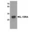 Interleukin 15 Receptor Subunit Alpha antibody, NBP2-41212, Novus Biologicals, Western Blot image 