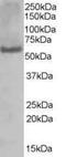 Poly(U) Binding Splicing Factor 60 antibody, PA5-18104, Invitrogen Antibodies, Western Blot image 