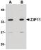 Solute Carrier Family 39 Member 11 antibody, PA5-20679, Invitrogen Antibodies, Western Blot image 