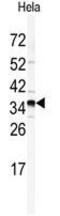 Golgi Phosphoprotein 3 antibody, GTX81443, GeneTex, Western Blot image 