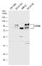 Activated Leukocyte Cell Adhesion Molecule antibody, GTX130098, GeneTex, Western Blot image 