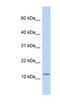 Cholecystokinin antibody, NBP1-59329, Novus Biologicals, Western Blot image 