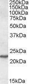 Secretion Associated Ras Related GTPase 1A antibody, GTX88575, GeneTex, Western Blot image 