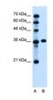 Patched 1 antibody, orb330375, Biorbyt, Western Blot image 