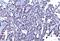 MutS Homolog 2 antibody, M00140-5, Boster Biological Technology, Immunohistochemistry paraffin image 