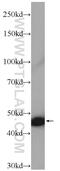 Interferon alpha-1 antibody, 18013-1-AP, Proteintech Group, Western Blot image 