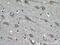 Kinesin Family Member 17 antibody, 14615-1-AP, Proteintech Group, Immunohistochemistry paraffin image 