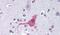 Endothelin Receptor Type B antibody, PA5-33499, Invitrogen Antibodies, Immunohistochemistry paraffin image 
