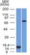 Matrix Metallopeptidase 2 antibody, GTX34845, GeneTex, Western Blot image 