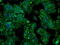 Prolactin antibody, GTX83803, GeneTex, Immunocytochemistry image 