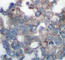 Ribosomal Protein S6 Kinase B1 antibody, AP0253, ABclonal Technology, Immunohistochemistry paraffin image 