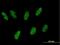 Zinc Finger Protein 343 antibody, H00079175-B01P, Novus Biologicals, Immunofluorescence image 
