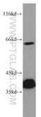 Plastin 3 antibody, 55216-1-AP, Proteintech Group, Western Blot image 