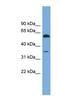 Serum Amyloid A Like 1 antibody, NBP1-57062, Novus Biologicals, Western Blot image 