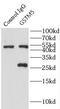 Glutathione S-Transferase Mu 5 antibody, FNab03695, FineTest, Immunoprecipitation image 