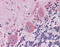 B-Raf Proto-Oncogene, Serine/Threonine Kinase antibody, 51-300, ProSci, Immunohistochemistry paraffin image 