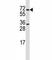 Protein Arginine Methyltransferase 5 antibody, F43243-0.4ML, NSJ Bioreagents, Western Blot image 