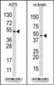 Hypoxia Inducible Factor 1 Subunit Alpha Inhibitor antibody, 55-125, ProSci, Western Blot image 