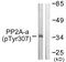 Protein Phosphatase 2 Catalytic Subunit Alpha antibody, PA5-38321, Invitrogen Antibodies, Western Blot image 