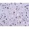 Programmed Cell Death 1 antibody, NBP1-75518, Novus Biologicals, Immunohistochemistry paraffin image 