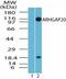 Rho GTPase Activating Protein 20 antibody, TA337061, Origene, Western Blot image 