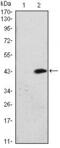 ATM Serine/Threonine Kinase antibody, MA5-15816, Invitrogen Antibodies, Western Blot image 