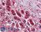 Transcription factor 21 antibody, LS-B3504, Lifespan Biosciences, Immunohistochemistry paraffin image 