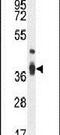 Transmembrane BAX Inhibitor Motif Containing 4 antibody, PA5-23998, Invitrogen Antibodies, Western Blot image 