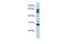 Transmembrane Protein 187 antibody, GTX46549, GeneTex, Western Blot image 