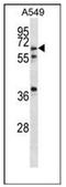 Glucagon Like Peptide 2 Receptor antibody, AP51856PU-N, Origene, Western Blot image 