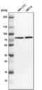 TBC1 Domain Family Member 15 antibody, PA5-53053, Invitrogen Antibodies, Western Blot image 