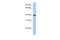 Oligodendrocyte Transcription Factor 2 antibody, 27-691, ProSci, Enzyme Linked Immunosorbent Assay image 