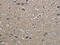 Heat Shock Protein Family A (Hsp70) Member 9 antibody, CSB-PA933674, Cusabio, Immunohistochemistry paraffin image 