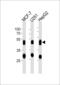 Cathepsin D antibody, LS-C203928, Lifespan Biosciences, Western Blot image 