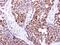 Deoxycytidine Kinase antibody, PA5-21846, Invitrogen Antibodies, Immunohistochemistry frozen image 