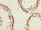 Endoplasmic Reticulum Metallopeptidase 1 antibody, LS-C682112, Lifespan Biosciences, Immunohistochemistry paraffin image 