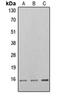 Eukaryotic Translation Initiation Factor 4E Binding Protein 1 antibody, orb216096, Biorbyt, Western Blot image 