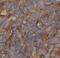 Angiopoietin Like 8 antibody, FNab09883, FineTest, Immunohistochemistry paraffin image 