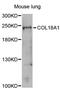 Collagen Type XVIII Alpha 1 Chain antibody, STJ23189, St John