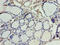 Serine Dehydratase Like antibody, CSB-PA020927LA01HU, Cusabio, Immunohistochemistry frozen image 