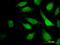 Trinucleotide Repeat Containing Adaptor 6C antibody, H00057690-M08, Novus Biologicals, Immunofluorescence image 