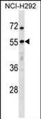 Ubiquitin Specific Peptidase 27 X-Linked antibody, PA5-71973, Invitrogen Antibodies, Western Blot image 