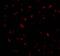 BMI1 Proto-Oncogene, Polycomb Ring Finger antibody, A00313, Boster Biological Technology, Immunofluorescence image 