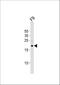 Teratocarcinoma-Derived Growth Factor 1 antibody, A03105, Boster Biological Technology, Western Blot image 