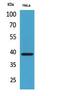 C-X-C Motif Chemokine Receptor 6 antibody, STJ96763, St John