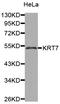 Keratin 7 antibody, LS-C332185, Lifespan Biosciences, Western Blot image 